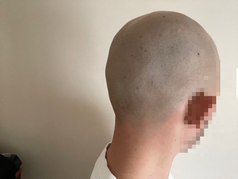 kensenシェーバーの深剃り性能