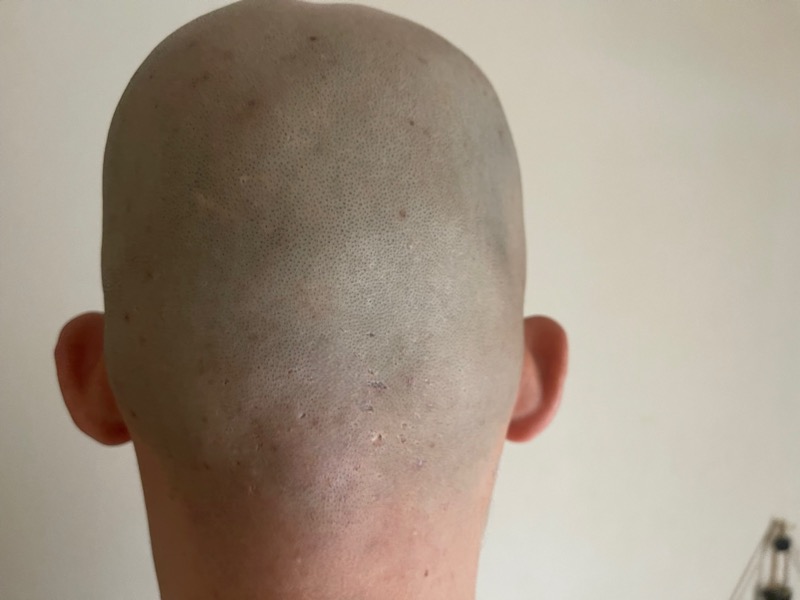 kensenシェーバーの深剃り性能